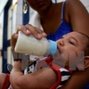 Em bé bị mắc chứng đầu nhỏ được theo dõi tại bệnh viện Oswaldo Cruz ở Cabo de Santo Agostinho thuộc Pernambuco, ​Đông Bắc Brazil. (Nguồn: THX/TTXVN)