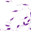 Ký sinh trùng gây ra bệnh Leishmania. Ảnh minh họa. (Nguồn: emaze.com)