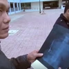 [Video] Bác sỹ để quên kéo trong bụng bệnh nhân suốt 18 năm