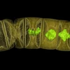 Ảnh chụp tia X hóa thạch giống tảo đỏ. (Nguồn: Reuters)