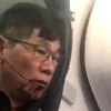 Bác sỹ gốc Việt David Dao bị kéo khỏi máy bay của United Airlines. (Nguồn: Twitter)