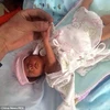 Trung Quốc: Bé gái sinh non sống sót sau 2 giờ bị chôn sống