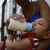 Một em bé bị mắc chứng đầu nhỏ ở bệnh viện Oswaldo Cruz ở Cabo de Santo Agostinho, Brazil. (Nguồn: THX/TTXVN)