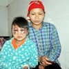 Lào Cai: Buộc thôi việc cô giáo đánh học sinh bầm tím mắt