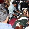 Chuyển người bị thương trong vụ hỏa hoạn tới bệnh viện ở Paravur ngày 10/4. (Nguồn: AFP/TTXVN)