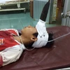 Bệnh nhân Tùng nhập viện cấp cứu trong tình trạng tỉnh táo. (Ảnh: Hưng Thịnh/Vietnam+)
