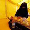 Bệnh nhân nhiễm tả được điều trị tại bệnh viện ở Sanaa ngày 22/7. (Nguồn: EPA/TTXVN)