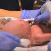 [Video] Người phụ nữ đầu tiên sinh con bằng tử cung được cấy ghép