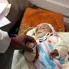 Trẻ em Yemen bị suy dinh dưỡng điều trị tại bệnh viện ở Sanaa. (Nguồn: THX/TTXVN)