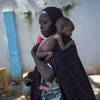 Trẻ em bị suy dinh dưỡng tại Maiduguri, Nigeria. (Nguồn: AFP/TTXVN)