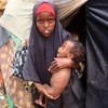 Một người mẹ trẻ bế đứa con suy dinh dưỡng tại một trung tâm y tế ở phia nam thủ đô Mogadishu, Somalia. (Ảnh: AFP/TTXVN)