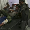 Nạn nhân bị thương sau vụ đánh bom liều chết ở thủ đô Kabul, Afghanistan ngày 24/10/2020. (Ảnh: AFP/TTXVN)