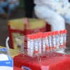 [Video] Biến chủng virus B.1.617.2 của Ấn Độ nguy hiểm thế nào?
