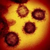 Hình ảnh biến thể Omicron của virus SARS-CoV-2 gây bệnh COVID-19 dưới kính hiển vi. (Ảnh: AFP/TTXVN)