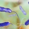 Vi khuẩn Legionella gây ra các triệu chứng từ cúm đến nhiễm trùng phổi nặng và viêm phổi ở người. (Nguồn: telegraphindia.com)