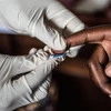 Lấy mẫu máu để xét nghiệm HIV/AIDS tại một cơ sở y tế tại Zambia. (Ảnh: TTXVN phát)
