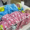 Lần đầu tiên tại Việt Nam, các y bác sỹ đã nuôi sống thành công cặp song sinh nặng 500g, chào đời ở tuần thai thứ 25. (Nguồn: suckhoedoisong.vn)