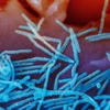 Hình ảnh virus hợp bào hô hấp ở người chụp bằng kính hiển vi điện tử có màu, với virus màu xanh lam và kháng thể màu vàng, bong ra khỏi bề mặt tế bào phổi người. (Nguồn: The New York Times)