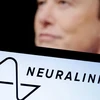 Logo Neuralink và tỷ phú Elon Musk. (Ảnh: China Daily)
