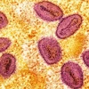 Virus đậu mùa khỉ. (Ảnh: Reuters)