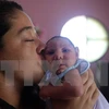Một em bé bị mắc chứng bệnh đầu nhỏ do mẹ bị nhiễm virus Zika khi mang thai tại Marica, Rio de Janeiro, Brazil. (Nguồn: THX/TTXVN)