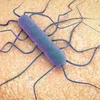 Vi khuẩn Listeria. (Nguồn: alamy)