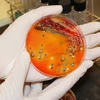 Vi khuẩn salmonella. (Nguồn: missouri.edu)