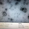 Viện vệ sinh dịch tễ Trung ương đã nuôi cấy và phân lập thành công virus corona mới. (Nguồn: Bộ Y tế)