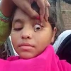 Bé gái Ấn Độ khóc ra những viên đá nhỏ. (Nguồn: odditycentral.com)
