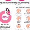 [Infographics] Đẩy lùi ung thư vú thông qua sàng lọc và phát hiện sớm