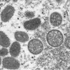 Hình ảnh virus đậu mùa khỉ được chiếu dưới kính hiển vi điện tử do Trung tâm kiểm soát và phòng ngừa dịch bệnh cung cấp. (Ảnh: AP/TTXVN) 