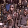 Nạn đói nghiêm trọng nhất thế giới tại Sudan 