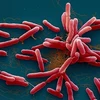 Hình ảnh vi khuẩn Burkholderia pseudomalei gây bệnh Whitmore. (Nguồn: Bộ Y tế)
