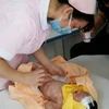 Trung Quốc: Bắt giữ gia đình bỏ rơi bé sơ sinh bị sứt môi