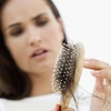 Khi tóc rụng nhiều bất thường, bạn cần nhanh chóng tìm giải pháp phù hợp.