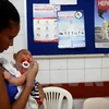 Một trẻ nhỏ bị mắc bệnh teo não do virus Zika ở Brazil. (Ảnh: THX/TTXVN)