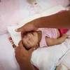 Một em bé mắc chứng đầu nhỏ liên quan đến virus Zika. (Nguồn: Reuters)