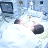 Hai bé song sinh dính liền nhau đang điều trị tại Bệnh viện Việt Đức. (Ảnh: PV/Vietnam+)