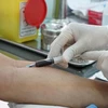 Bệnh nhân HIV kiểm tra máu tại một cơ sở y tế. (Ảnh: Phương Vy/TTXVN)