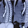 Phim chụp X quang của bệnh nhân. (Ảnh: PV/Vietnam+)