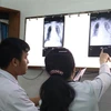 Các bác sỹ Bệnh viện Chợ Rẫy Thành phố Hồ Chí Minh kiểm tra tình trạng phổi của bệnh nhân Li Ding ngày 30/1. (Ảnh: Đinh Hằng/TTXVN)