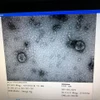 Viện vệ sinh dịch tễ Trung ương đã nuôi cấy và phân lập thành công virus corona mới.
