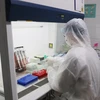 Thử nghiệm thiết bị xét nghiệm chẩn đoán SARS CoV-2. (Ảnh: Hoàng Nguyên/TTXVN)