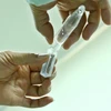Nghiên cứu định lượng protein trong vắcxin tại phòng thí nghiệm của Công ty TNHH MTV Vắc xin và sinh phẩm số 1 (Vabiotech). (Ảnh: Minh Quyết/TTXVN)