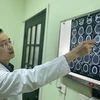 Tiến sỹ Bùi Huy Mạnh xem phim chụp của bệnh nhân. (Ảnh: PV/Vietnam+)