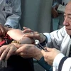 Giáo sư, bác sỹ Nguyễn Tài Thu châm cứu cho bệnh nhân. (Nguồn: TTXVN)