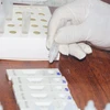 Thực hiện test nhanh các mẫu bệnh phẩm để phát hiện COVID-19. (Ảnh: TTXVN/Vietnam+)