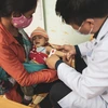 Việt Nam cần nhanh giải quyết suy dinh dưỡng cấp tính nặng ở trẻ em