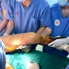 Các bác sỹ thực hiện ca cấp cứu phẫu thuật cho bệnh nhân. (Ảnh: PV/Vietnam+)