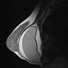 Hình ảnh chụp MRI ngực của một bệnh nhân tại Bệnh viện Đại học Y Hà Nội. (Ảnh: BVCC)